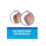 6 Pack O'Keefes 3200 O'Keeffe's for Healthy Feet Creme 3.2-oz Grip Pak - Image 3