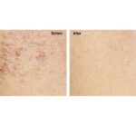 Advanced Clinicals Luxury Pure Argan Oil. Lightweight facial Oil Reduces the Appearance of Wrinkles and hydrates dry skin. 1.8 Fl Oz. - Image 3