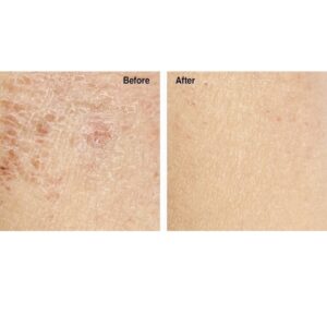 Advanced Clinicals Luxury Pure Argan Oil. Lightweight facial Oil Reduces the Appearance of Wrinkles and hydrates dry skin. 1.8 Fl Oz. - Image 3