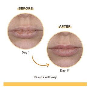 Burt's Bees Rescue Lip Balm Soothing Eucalyptus, 4.25g - Image 5