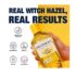 Dickinson's Original Witch Hazel Pore Perfecting Toner - Image 3