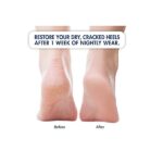 Dr. Frederick's Original Moisturizing Heel Socks for Cracked Heel Treatment - 2 Pairs - Stop Cracked Heels in Their Tracks - Image 2