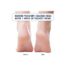 Dr. Frederick's Original Moisturizing Heel Socks for Cracked Heel Treatment - 2 Pairs - Stop Cracked Heels in Their Tracks - Image 2