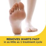 Dr. Scholl's Freeze Away Wart Remover, 12 Treatments - Image 3