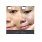 Mighty Patch Original - Hydrocolloid Acne Pimple Patch for Covering Zits and Blemishes, Spot Stickers for Face and Skin, Vegan-friendly and Not Tested on Animals (36 Count) - Image 3