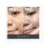 Mighty Patch Original - Hydrocolloid Acne Pimple Patch for Covering Zits and Blemishes, Spot Stickers for Face and Skin, Vegan-friendly and Not Tested on Animals (36 Count) - Image 3
