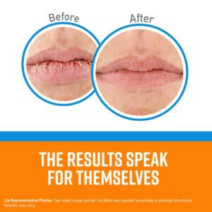 O'Keeffe's Cooling Relief Lip Repair Lip Balm for Dry, Cracked Lips, Stick, (Pack of 9) - Image 2