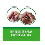 O'Keeffe's Hand Cream for Wood-working, Plastering, Masonry, Gutter-installation, Dry-walling (Dry Skin) 100 ml - Image 4