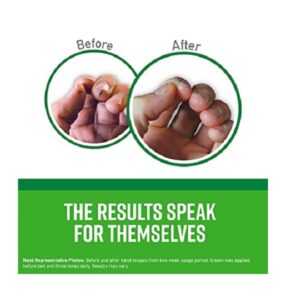 O'Keeffe's Hand Cream for Wood-working, Plastering, Masonry, Gutter-installation, Dry-walling (Dry Skin) 100 ml - Image 4