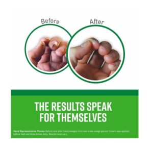 O'Keeffe's K0350002-5 Working Hands Hand Cream in Jar (5 Pack), 3.4 oz - Image 3