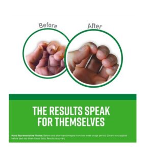 O'Keeffe's K0350002-8 Working Hands Hand Cream in Jar (8 Pack), 3.4 oz - Image 3