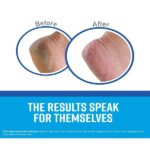 O Keeffes K0350015 Working Hands 3.4 oz & Healthy Feet 3.2 oz Combination Pack of Jars - Image 7