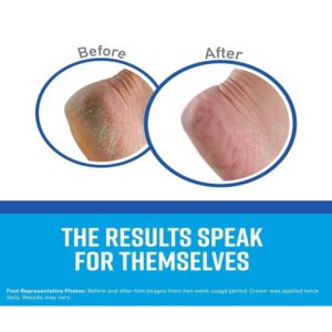 O Keeffes K0350015 Working Hands 3.4 oz & Healthy Feet 3.2 oz Combination Pack of Jars - Image 7