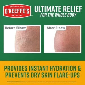 O'Keeffe's K0700008 Skin Repair Tube, 7 oz - Image 6