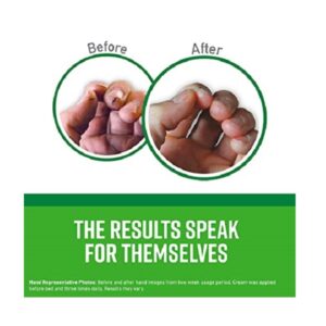 O'Keeffe's Working Hands Hand Cream, 3.4 Ounce Jar, (Pack of 3) - Image 3