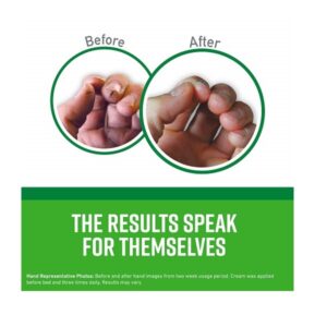 O'Keeffe's Working Hands Hand Cream, 3.4 oz., Jar, (Pack of 4) - Image 3