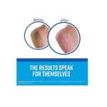 O'Keeffe's Working Hands & Healthy Feet Combination Pack of Tubes - Image 6