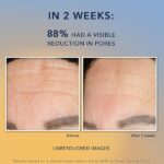 RoC Multi Correxion Revive + Glow Gel Facial Cleanser With Vitamin C, & Glycolic Acid, Paraben-Free, Sulfate-Free Skin Care, 6 Ounces - Image 5