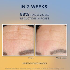 RoC Multi Correxion Revive + Glow Gel Facial Cleanser With Vitamin C, & Glycolic Acid, Paraben-Free, Sulfate-Free Skin Care, 6 Ounces - Image 5