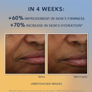 RoC Multi Correxion Revive + Glow Vitamin C Face Moisturizer, Anti-Aging Gel Cream, Hypo-Allegenic & Oil-Free Skin Care, 1.7 Ounce - Image 3