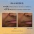 RoC Multi Correxion Revive + Glow Vitamin C Face Moisturizer, Anti-Aging Gel Cream, Hypo-Allegenic & Oil-Free Skin Care, 1.7 Ounce - Image 3