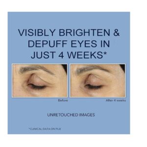 Roc Retinol Correxion Eye Cream 0.5 Ounce - Image 4