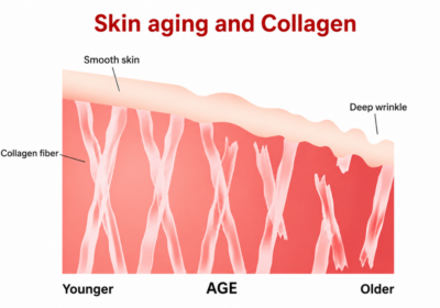 Skin aging and collagen decline infographic