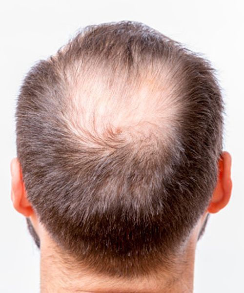 Crown thinning stage